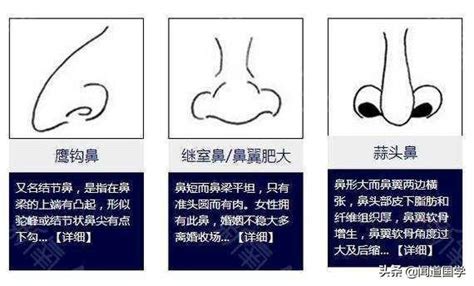 鼻翼 面相|准头、鼻子、鼻翼、鼻梁的面相三六风水网